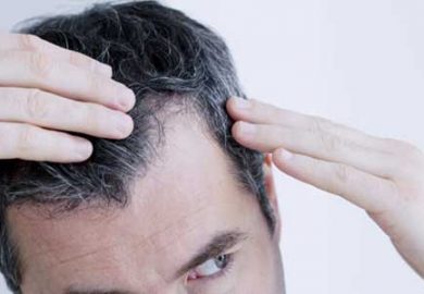 Die Haartransplantation (mit der FUE Technik)